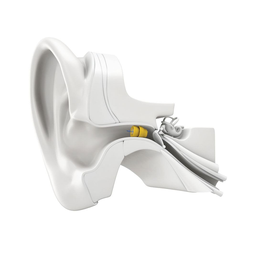 Phonak Lyric Invisible Hearing Aid - 3 Years Subscription (Monaural)