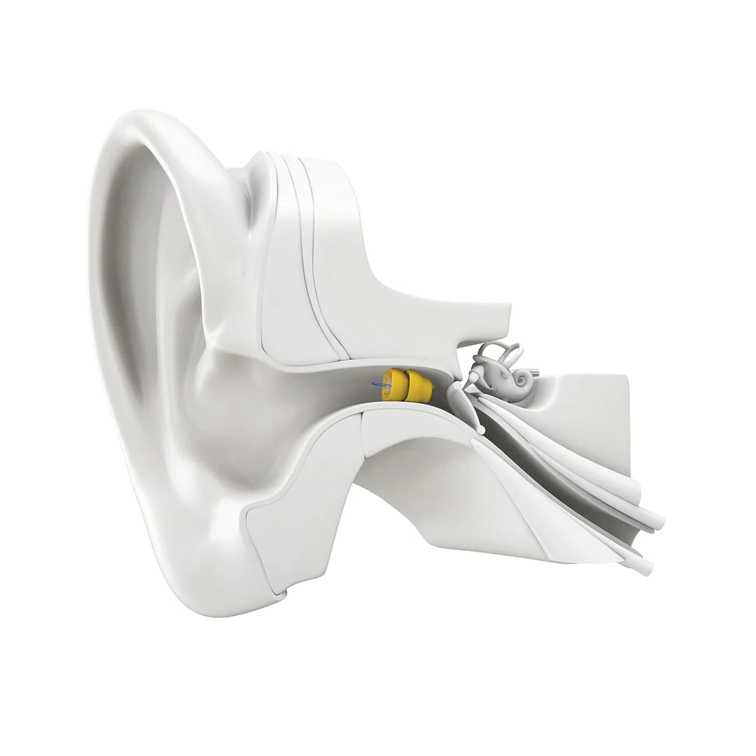 Phonak Lyric Invisible Hearing Aid - 1 Year Subscription (Binaural)