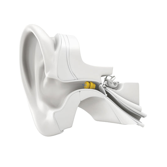 Phonak Lyric Invisible Hearing Aid - 2 Years Subscription (Monaural)